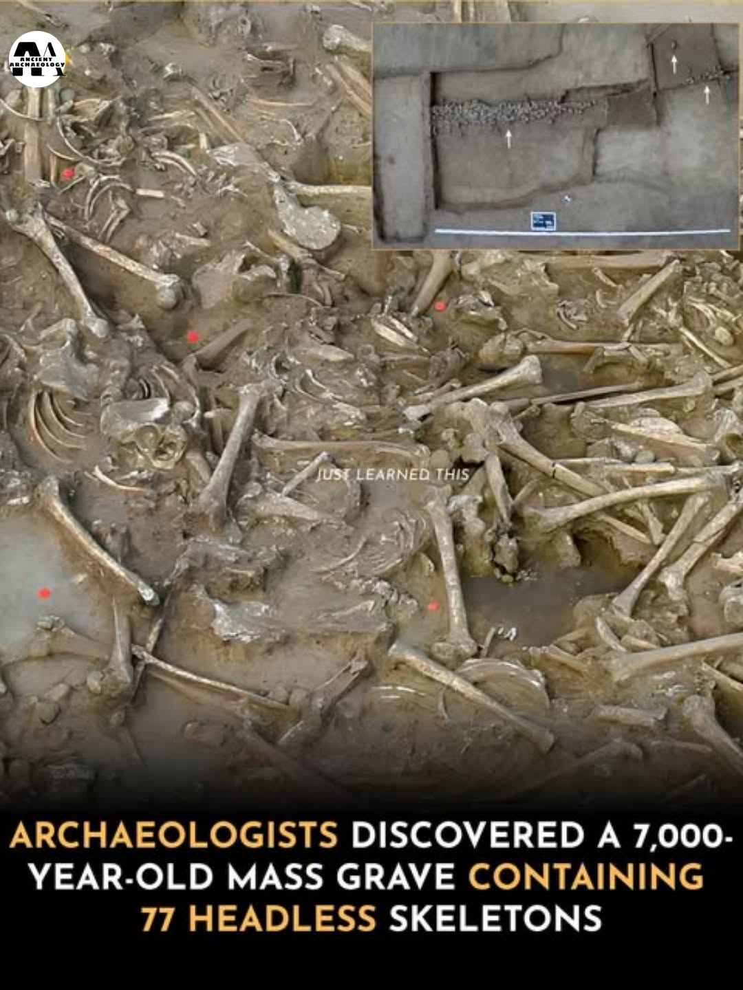 Có thể là hình ảnh về xương và văn bản cho biết '中科博81881 JUSE LEARNED JUSELEARNEDTHIS THIS ARCHAEOLOGISTS DISCOVERED A 7,000- YEAR-OLD YEAR OLD Mᴀss GRAVE CONTAINING 77 HEADLESS SKELETONS'